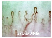 指先毛細血管血流検査