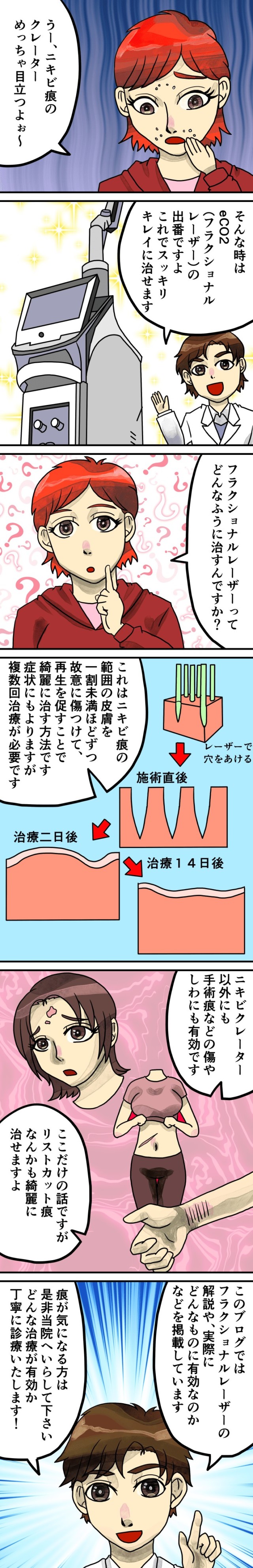 eCO2エコツーフラクショナルレーザー!効果持続やダウンタイム